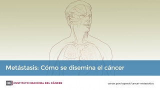 Metástasis Cómo se disemina el cáncer [upl. by Alanah]