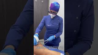 Tratamiento para la Celulitis  Dr Angélica Domínguez Dermatóloga en bogotá [upl. by Eidson432]