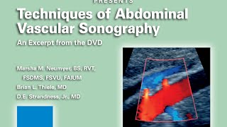 Techniques of Abdominal Vascular Sonography  01 [upl. by Ilrahs]