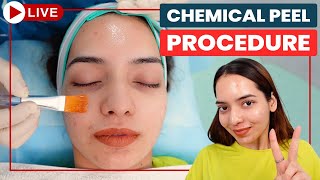 CHEMICAL PEELS Step by Step  Acne Scar Treatment in Delhi  Chemical Peeling Treatment Dr Jangid [upl. by Adnahc859]