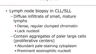 Chapter 28 Mature Lymphoid Neoplasms [upl. by Caren]