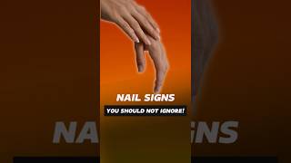 10 Nail Warning Signs You Should Never Ignore for Your Health healthtips health short [upl. by Millman597]