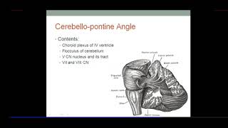 Brainstem PONS Clinical Anatomy Millard Gubler Syndrome Pontine Haemorrhage By Dr Azmi Mohsin [upl. by Nosneb389]