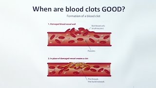 Anticoagulants [upl. by Enitsuga]