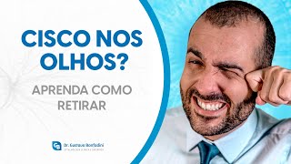 Cisco nos olhos Descubra como retirar sem machucar • Dr Gustavo Bonfadini [upl. by Yatnuhs]