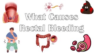 What Causes Per Rectal Bleeding Major Causes Of Blood In Stools Rectal Bleeding Causes [upl. by Borrell]