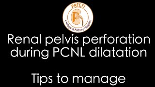 Renal pelvis perforation during PCNL dilatation  Tips to manage [upl. by Aneeled]