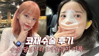 코재수술 VLOG✨10년 전에 했던 코수술 부작용이 왔었어요🥲 [upl. by Halimak]