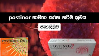 උපත් පාලනයට postinor භාවිතා කරන නිවැරදි ආකාරය 😨 How to use postinor 1 and 2 tablets sinhala [upl. by Xenophon162]