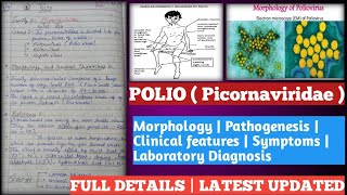 polio  poliomyelitis in hindi  polio vaccination  polio disease in hindi  polio in hindi [upl. by Liana129]