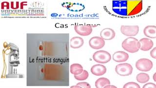 MORPHOLOGIE EN HEMATOLOGIE EPISODE 4 [upl. by Jansson]