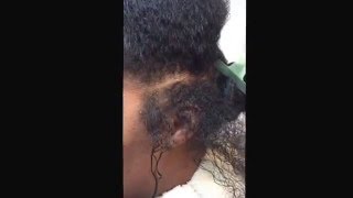 Oxygen Treatment on the scalp for healthier hair lifestyle Using Burdock root and Chlorophyll [upl. by Adoc286]