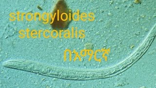 strongyloides stercoralis in Amharic language unit two medical parasitology [upl. by Haidabej448]