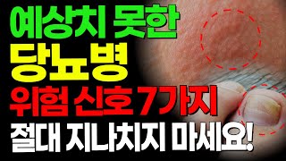 절대 놓치지 마세요 모른다면 후회할 당뇨병의 위험한 7가지 증상은 당뇨병에 나쁜 음식과 좋은 음식 총정리 [upl. by Henleigh946]