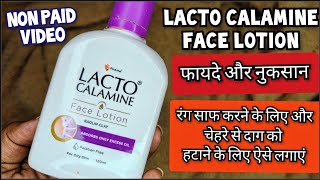 Lacto Calamine Face Lotion लैक्टो कैलामाइन लोशन  How to use lacto calamine lotion Review In Hindi [upl. by Htehpaj]