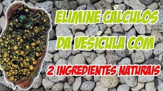 Elime Cálculos da Vesícula com Apenas 2 Ingredientes [upl. by Kachine]