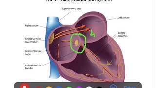 ECG Basics 10 Junctional Escape Rhythm [upl. by Aneral135]