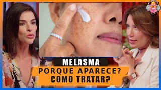 A Melhor explicação sobre Mancha no Rosto de MELASMA como aparece e como tratar [upl. by Hudson935]