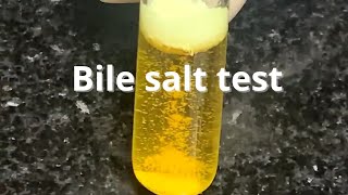 Bile Salt Test [upl. by Egwan521]