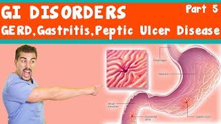 GI Disorders GERD Gastritis peptic ulcer Disease Part 5 [upl. by Bernadine]