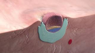 Implantation of the blastocyst [upl. by Magnusson]