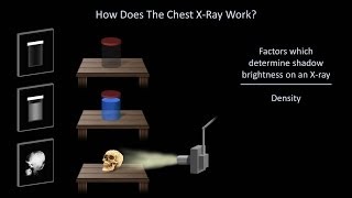 How to Interpret a Chest XRay Lesson 1  An Introduction [upl. by Cicenia]