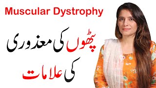 Muscular Dystrophy Signs amp Symptoms  Dr Afaf Manzoor [upl. by Annaerb]