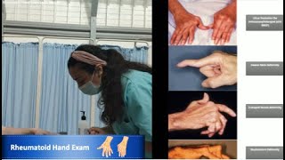 Mayo Medics Rheumatoid Hand Examination [upl. by Watt]