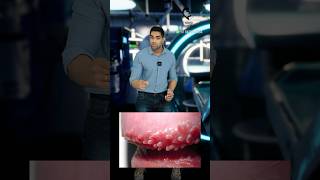 ஆணுறுப்புக்குள் சிறு பருக்களா Pearly penile papules Dr Isacc Abbas [upl. by Amahcen]