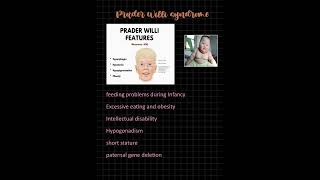 PRADER WILLI SYNDROME MNEMONIC fmge study MBBS [upl. by Iny]