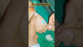 IV Cannula technique cannula  IV Cannula kaise Lagaye how to insert IV Cannula short video reel [upl. by Sylera]