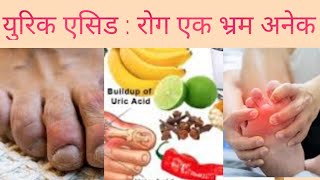 Uric acid and Myths in Nepali Dr Bhupendra shah  doctor sathi [upl. by Pozzy]