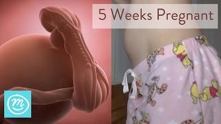 5 Weeks Pregnant What You Need To Know  Channel Mum [upl. by Jaffe678]