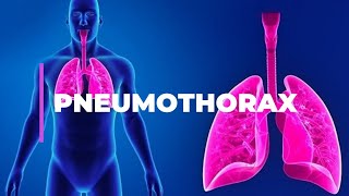 Pneumothorax I lung physiology I pulmonary medicine part 1 [upl. by Nylad227]