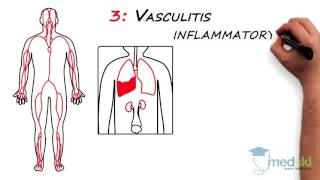 Rheumatology – Polyarticular Pain By Lori Albert MD [upl. by Eboh615]