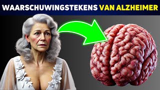 SCHOKKEND Deze 5 Gewoonten Zijn Verbonden met Alzheimer [upl. by Alat]