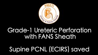 Grade1 Ureteric Perforation with FANS Sheath  Supine PCNL ECIRS saved [upl. by Aneehsyt]