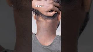 Remove Neck Darkness At Home In 5min  Neck Cleaning Tips  Dark Neck Remove Home Remedies shorts [upl. by Judd]