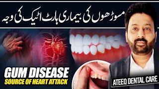 Gum Disease A Hidden Source of Heart Attack [upl. by Buchheim]