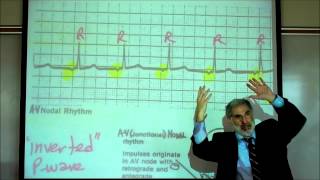 CARDIAC PHYSIOLOGY PART 3 by Professor Finkwmv [upl. by Bonis]