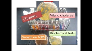 Cholera  Vibrio cholerae [upl. by Juliano]