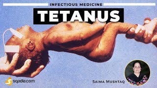 Tetanus  Definition  Infectious Medicine Video Lectures  VLearning [upl. by Mari607]