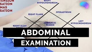 Abdominal Examination  OSCE Guide Latest  UKMLA  CPSA [upl. by Haon288]