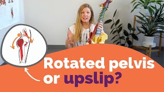 Rotated pelvis or upslip [upl. by Philis]