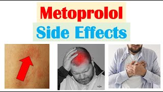 Metoprolol amp Beta Blockers Side Effects amp Why They Occur [upl. by Dragone]