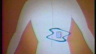 Ronco Back Relief 01  TV commercial 1981 [upl. by Aihsekel208]