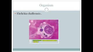 Ehrlichiosis An integrated discussion for USMLE step 1 [upl. by Alad]