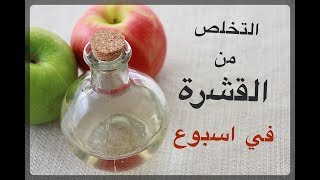 هاام للرجال والنساء  علاج نهائى لقشرة الشعر [upl. by Camroc]