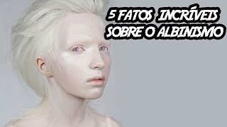 5 fatos incríveis sobre o albinismo [upl. by Nnayd]