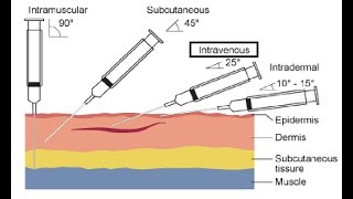 Intravenous IV Cannulation Procedures [upl. by Eelimaj921]